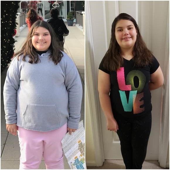 Smiling young girl before and after CHKD's Healthy You for Life program.